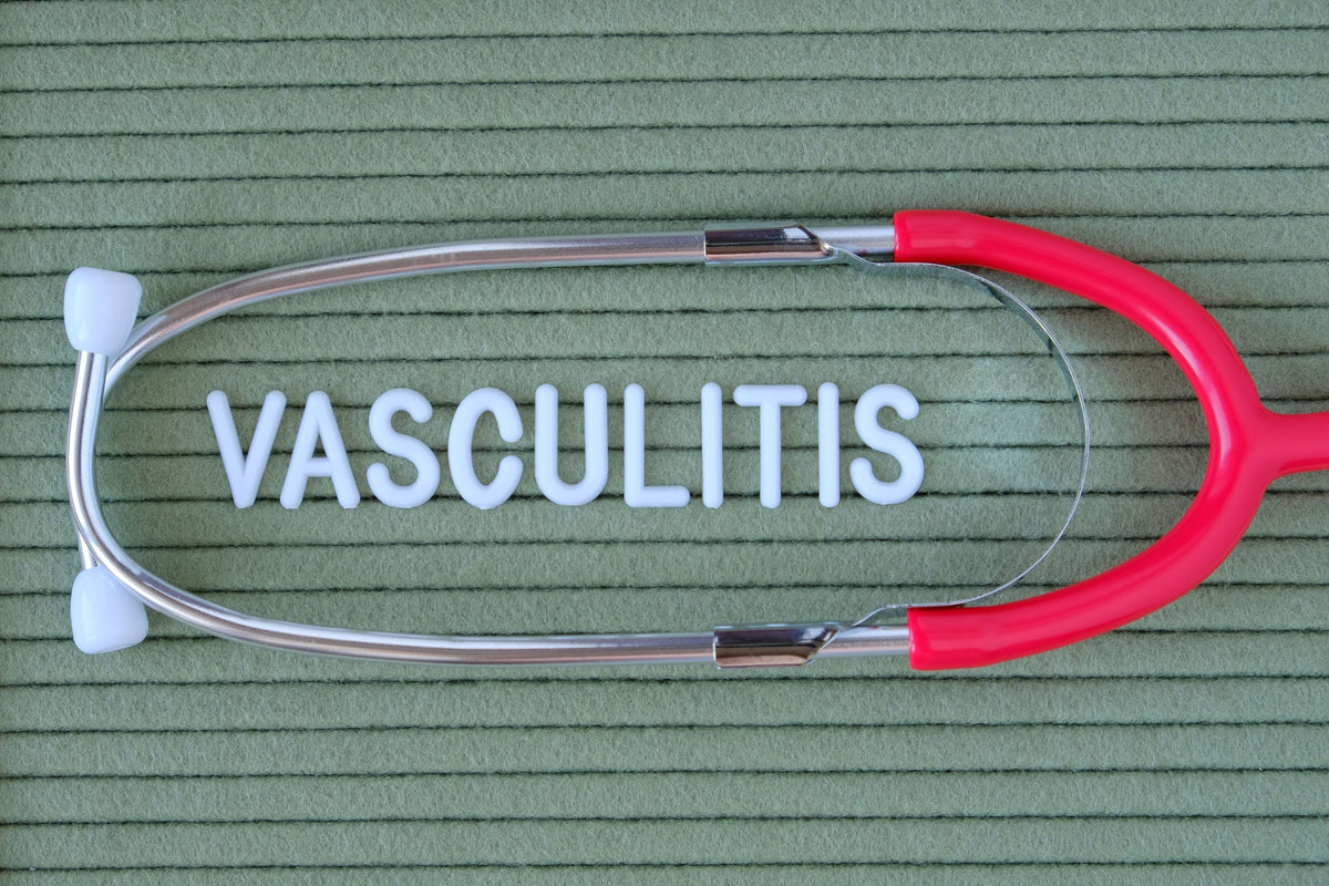 Vasculitis Causes Symptoms And Treatment Viasox 5455