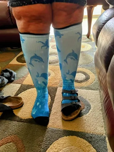 Blue dolphin-pattern Compression socks worn standing at home